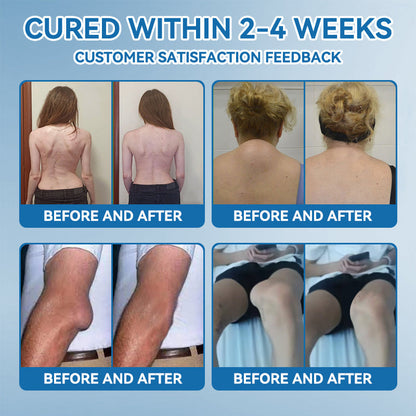 💥𝐅𝐃𝐀 𝐀𝐩𝐩𝐫𝐨𝐯𝐞𝐝|Picpii® 𝑩𝐏𝐂-𝟏𝟓𝟕 𝐉𝐨𝐢𝐧𝐭 𝐇𝐞𝐚𝐥𝐢𝐧𝐠 𝐂𝐫𝐞𝐚𝐦🦴 Relief for Arthritis, Neuropathy, Rheumatism & Sports Injuries ⏰