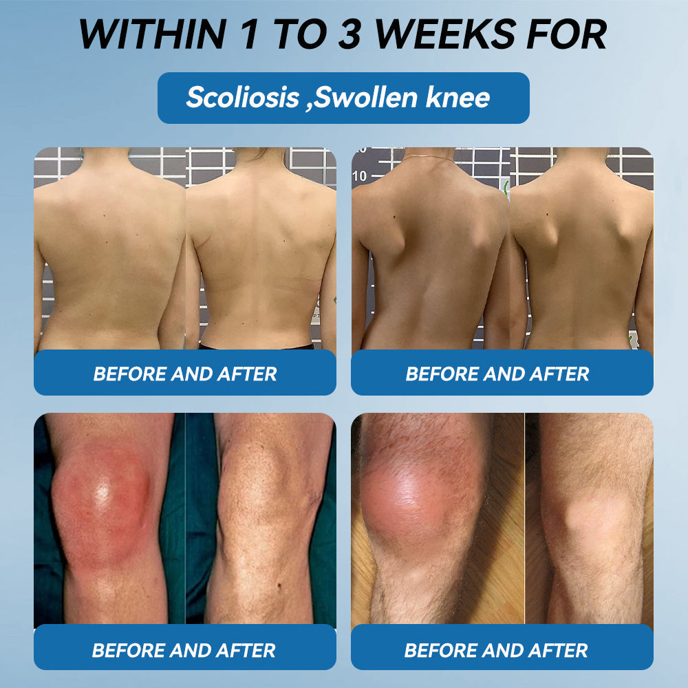 💥𝐅𝐃𝐀 𝐀𝐩𝐩𝐫𝐨𝐯𝐞𝐝|Picpii® 𝑩𝐏𝐂-𝟏𝟓𝟕 𝐉𝐨𝐢𝐧𝐭 𝐇𝐞𝐚𝐥𝐢𝐧𝐠 𝐂𝐫𝐞𝐚𝐦🦴 Relief for Arthritis, Neuropathy, Rheumatism & Sports Injuries ⏰