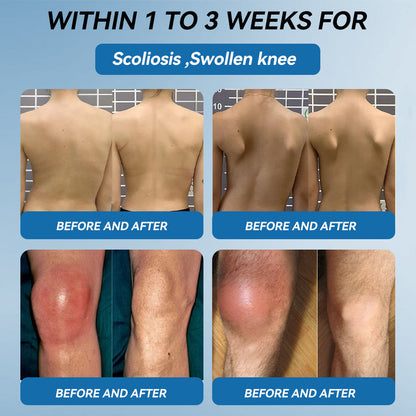 💥𝐅𝐃𝐀 𝐀𝐩𝐩𝐫𝐨𝐯𝐞𝐝|Picpii® 𝑩𝐏𝐂-𝟏𝟓𝟕 𝐉𝐨𝐢𝐧𝐭 𝐇𝐞𝐚𝐥𝐢𝐧𝐠 𝐂𝐫𝐞𝐚𝐦🦴 Relief for Arthritis, Neuropathy, Rheumatism & Sports Injuries ⏰