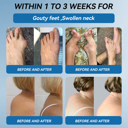 💥𝐅𝐃𝐀 𝐀𝐩𝐩𝐫𝐨𝐯𝐞𝐝|Picpii® 𝑩𝐏𝐂-𝟏𝟓𝟕 𝐉𝐨𝐢𝐧𝐭 𝐇𝐞𝐚𝐥𝐢𝐧𝐠 𝐂𝐫𝐞𝐚𝐦🦴 Relief for Arthritis, Neuropathy, Rheumatism & Sports Injuries ⏰